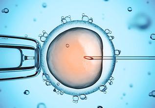 无精症成功案例